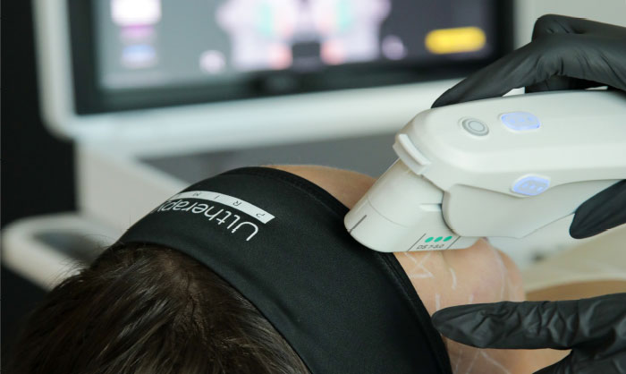 Ultherapy Prime lifting non invasivo