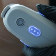 Ultrasuoni microfocalizzati ecoguidati: cosa sono e come funzionano