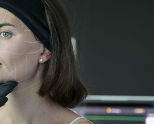 Trattamento di ringiovanimento viso: scopri Ultherapy PRIME®