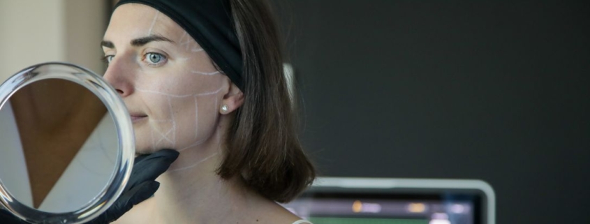 Trattamento di ringiovanimento viso: scopri Ultherapy PRIME®